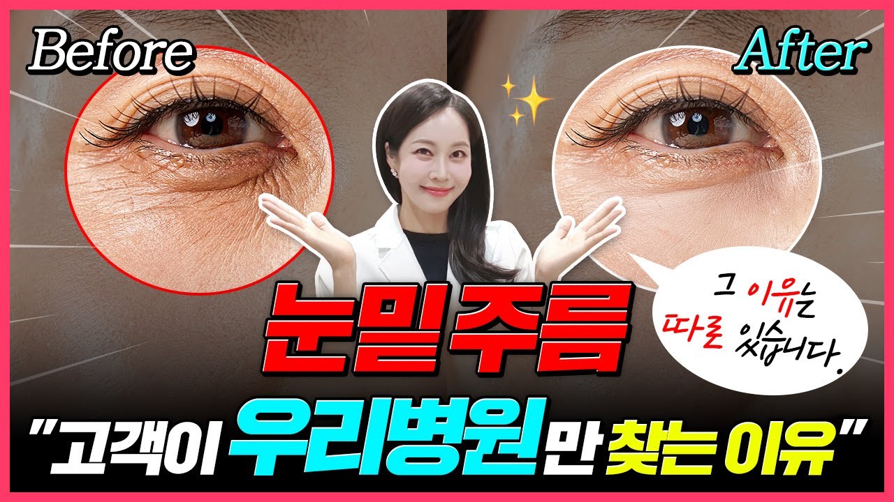 눈밑주름, 진짜 펴는 방법 공개❗ 10년 시술 노하우 전부 알려드립니다