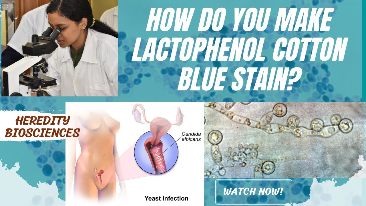 How do you make Lactophenol cotton blue stain? 