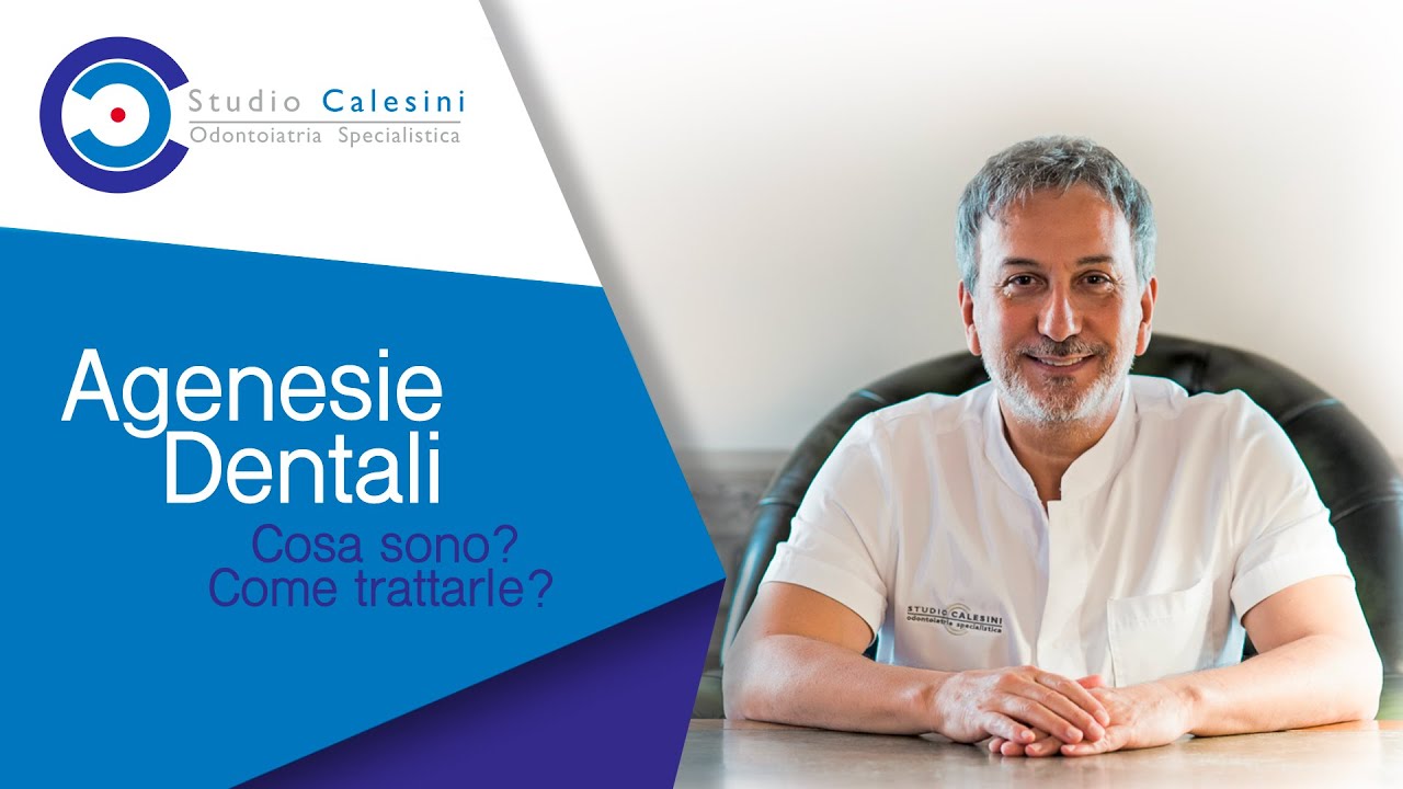 Agenesie dentali: Cosa sono? Come trattarle?