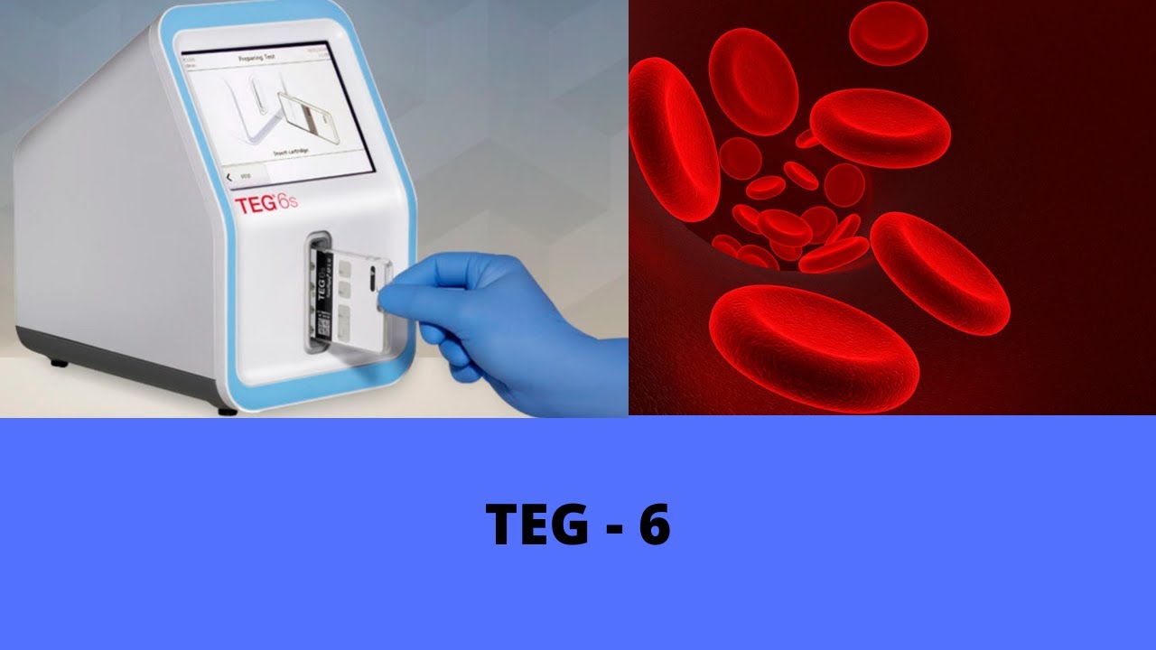 TEG - 6