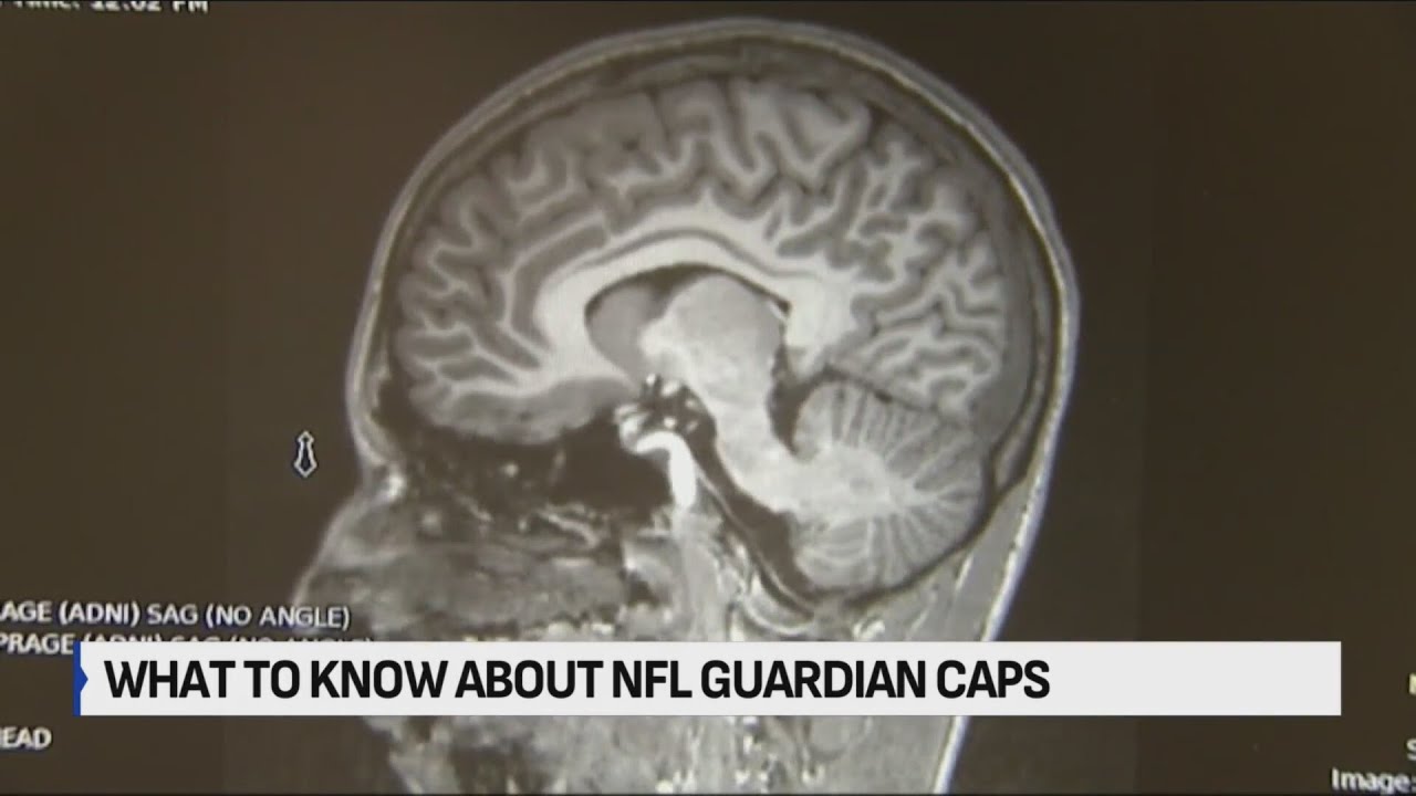 What to know about NFL guardian caps