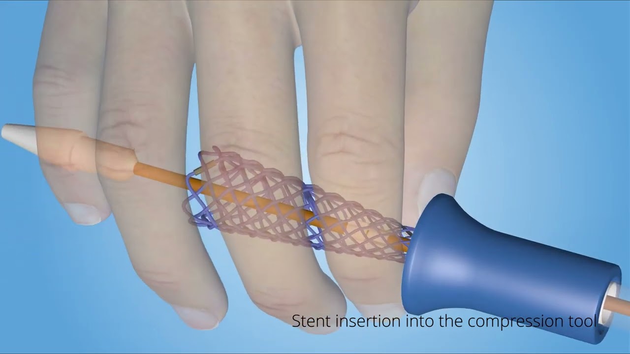 BD Biliary THP - 3D animation