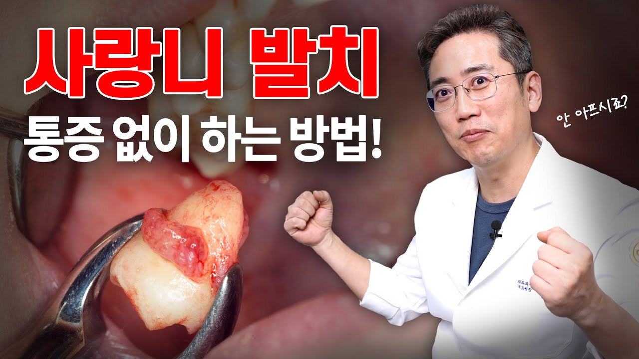 사랑니 발치가 두렵다면 이 영상을 시청하세요