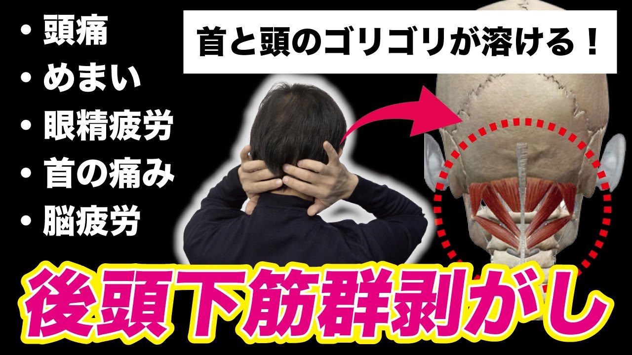 【後頭下筋群はがし】※ガンコな首こりに効きまくる！頭痛も脳疲労も消えるからやってみて