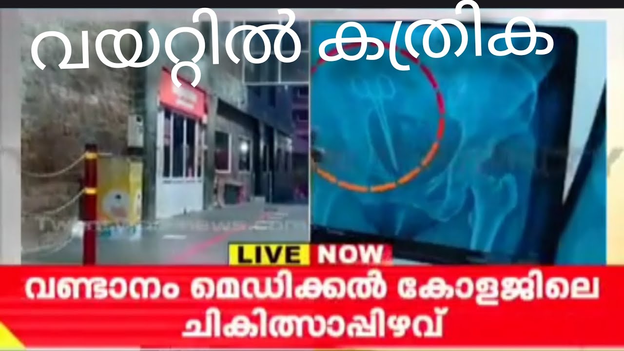 20 വർഷം പഴക്കമുള്ളതെന്നു ഡോക്ടർ!!latest.#shorts #അഗ്നിചിറകുകള് #viral #trending #politics #asianet 