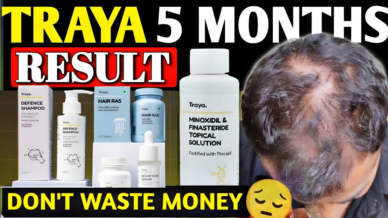 Traya 5 Month Result | Traya Hair Review | Honest Traya Review | Is Traya Good Or Bad 