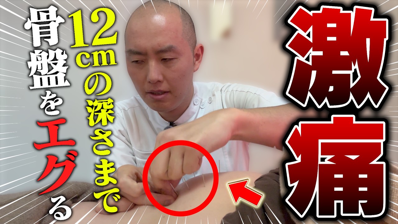 【腰椎ヘルニア】骨盤の奥深く