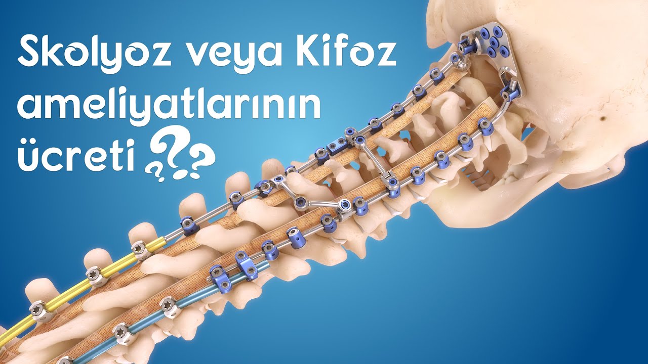 Skolyoz ve kifoz ameliyatlarının ücreti nedir?