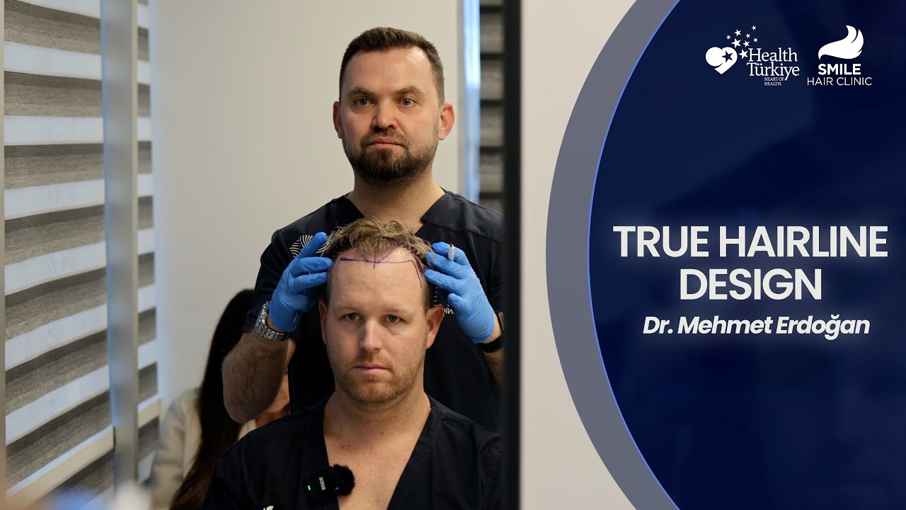 True Hairline Design in Hair Transplant | Consultation with Dr. Mehmet Erdoğan | Smile Hair Clinic