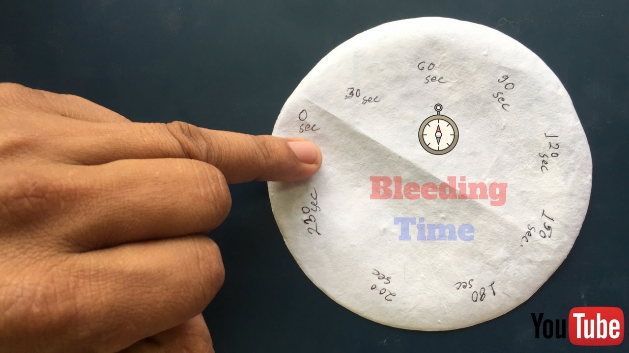 Bleeding Time Determination | ब्लीडिंग टाइम कैसे पता करें | Bleeding Time Determination test