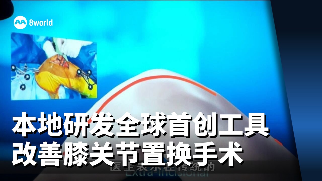 把五个切口减少到一个 本地研发全球首创工具改善膝关节置换手术