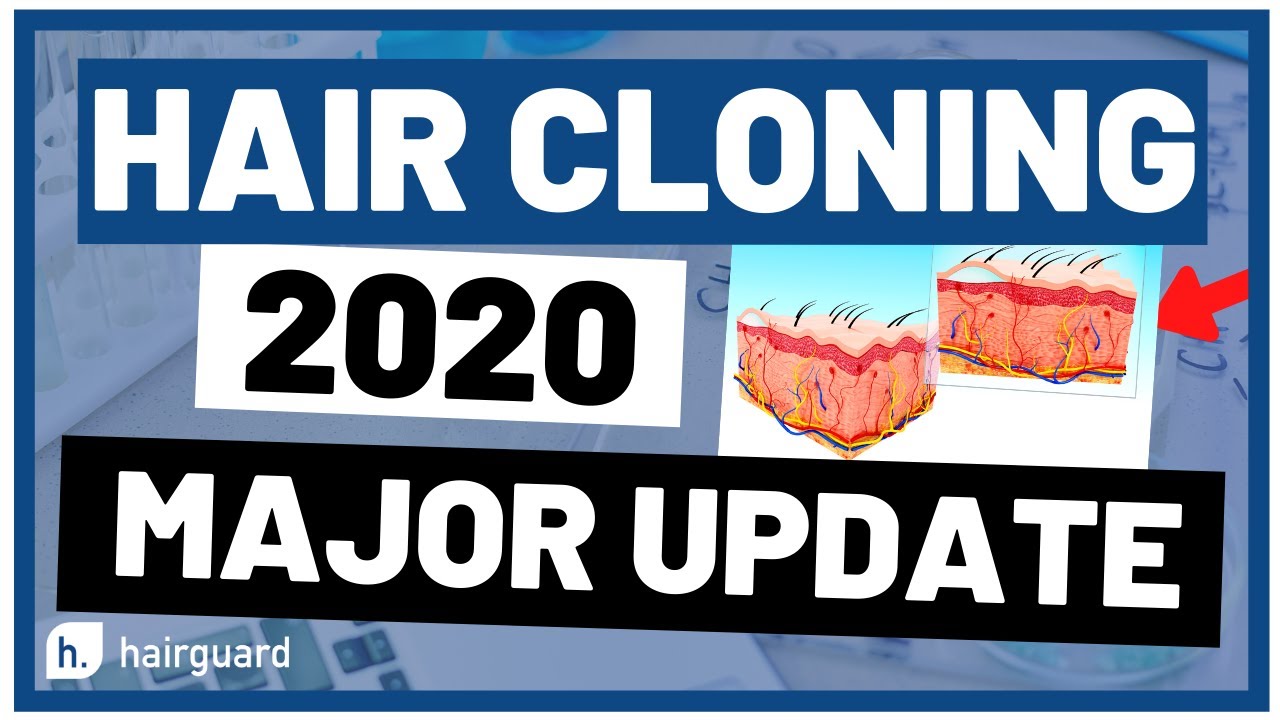 Hair Cloning: Major Updates You Must Know About