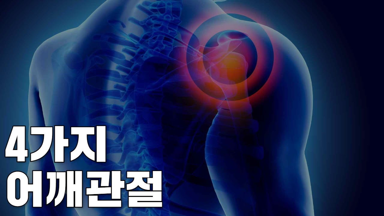 이정도는 알고 어깨재활 합시다! 어깨통증은 이곳들에서 생깁니다.