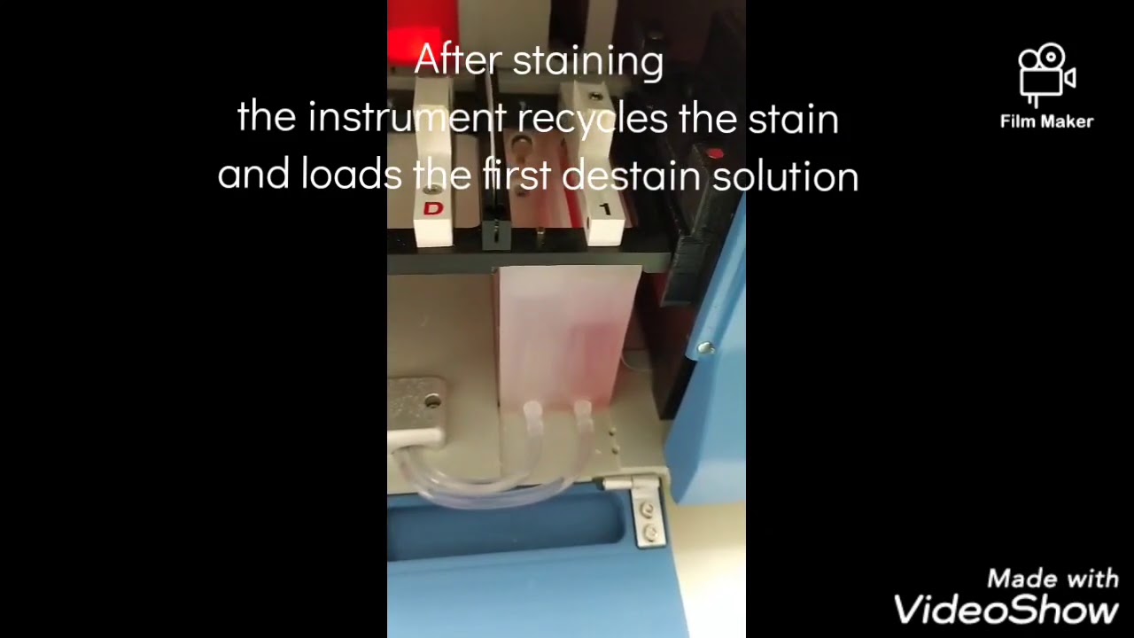 Preparation and execution of hemoglobin electrophoresis on Miniphor TS