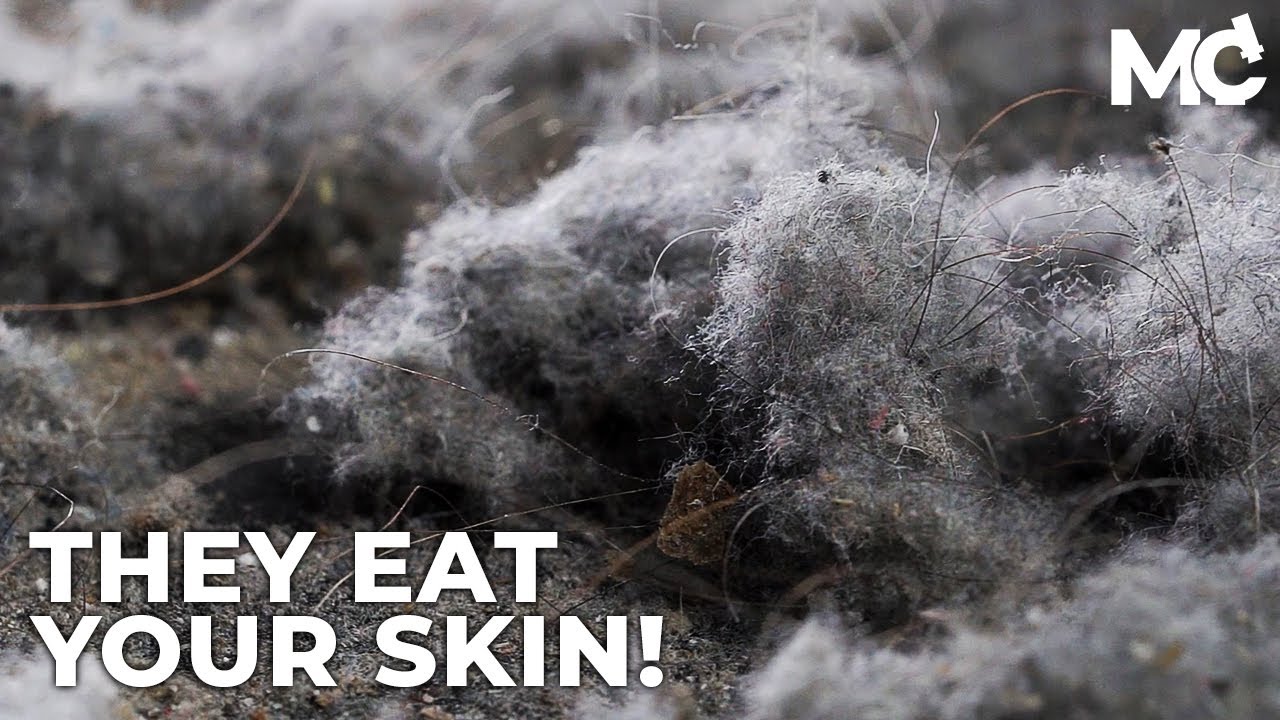 Dust Under The Microscope : Dust Mites Eat Your Skin Cells