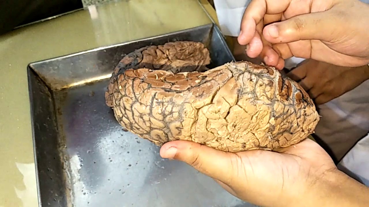 Cerebrum Demonstration by Mahbub Sir