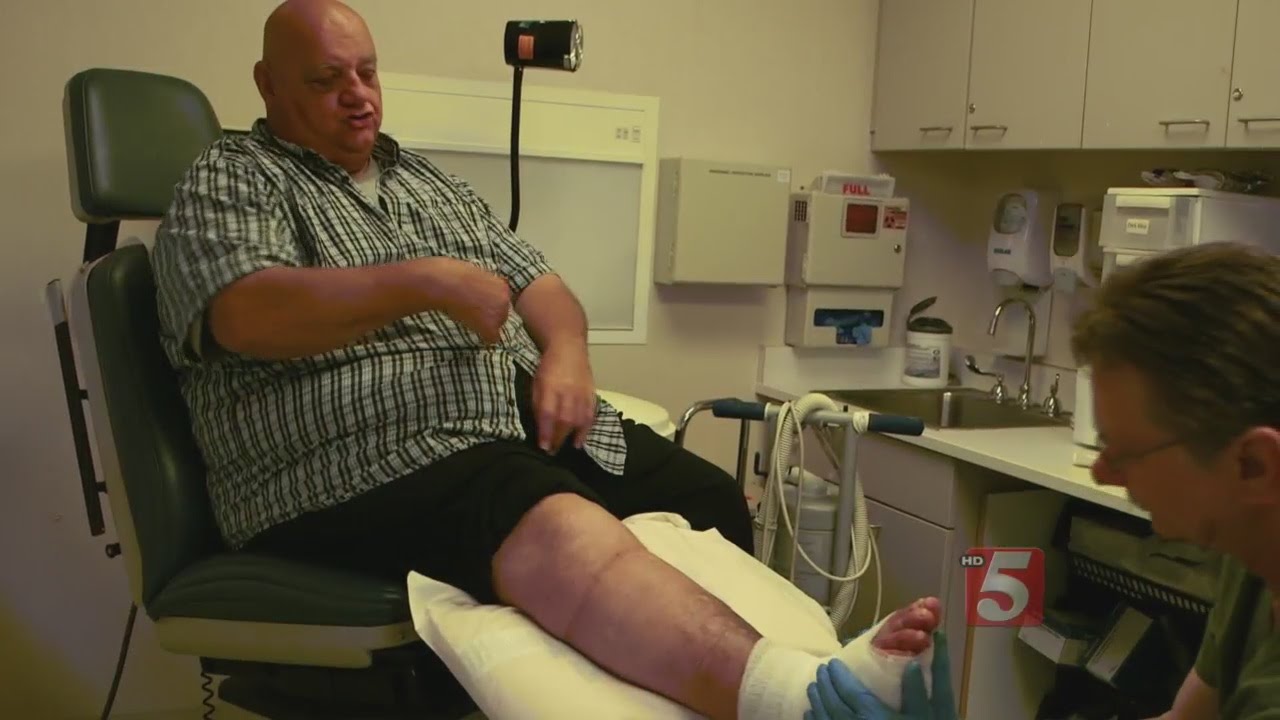 Charcot Foot: A Step Toward Avoiding Amputation