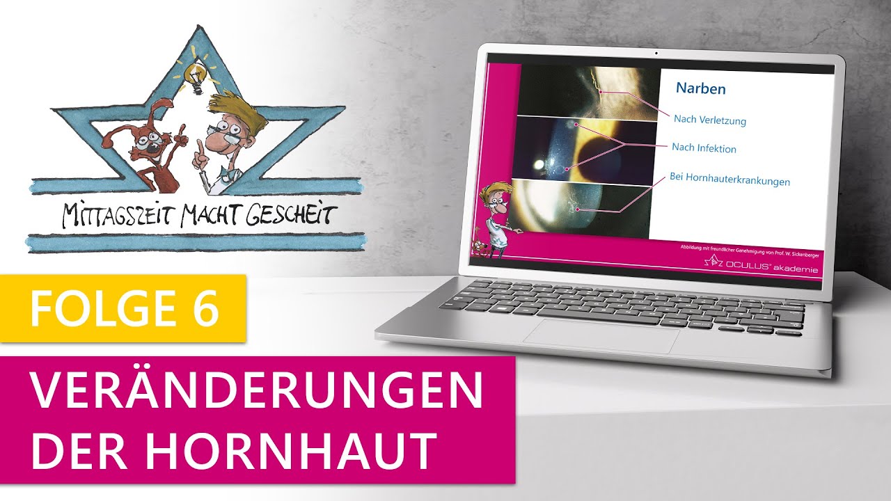 Veränderungen der Hornhaut (Mittagszeit macht gescheit – Folge 6)