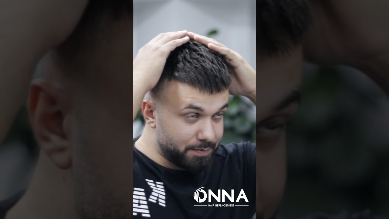 Protez Sa&ccedil; - Hair Replacement