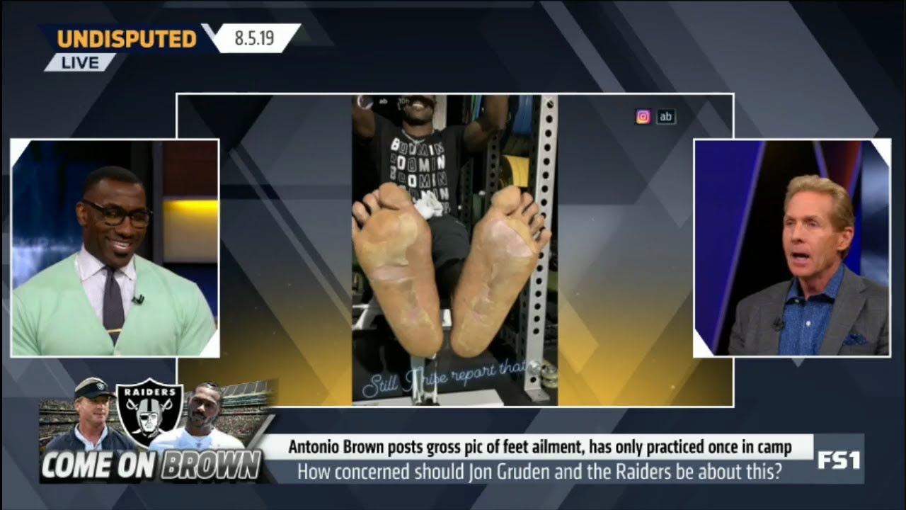 Undisputed | Antonio Brown posts gross pic of feet ailment, has only practiced once in camp