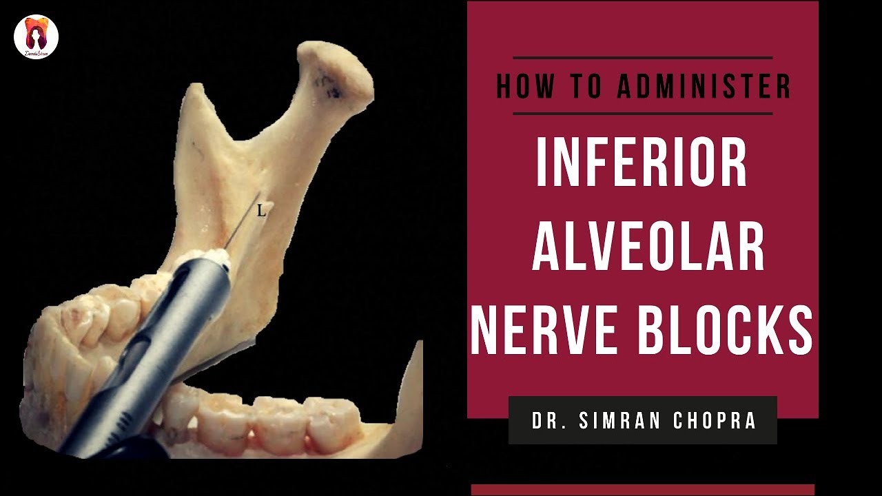 Inferior Alveolar Nerve Block Technique l Mandibular Nerve Block l Nerve Block Technique