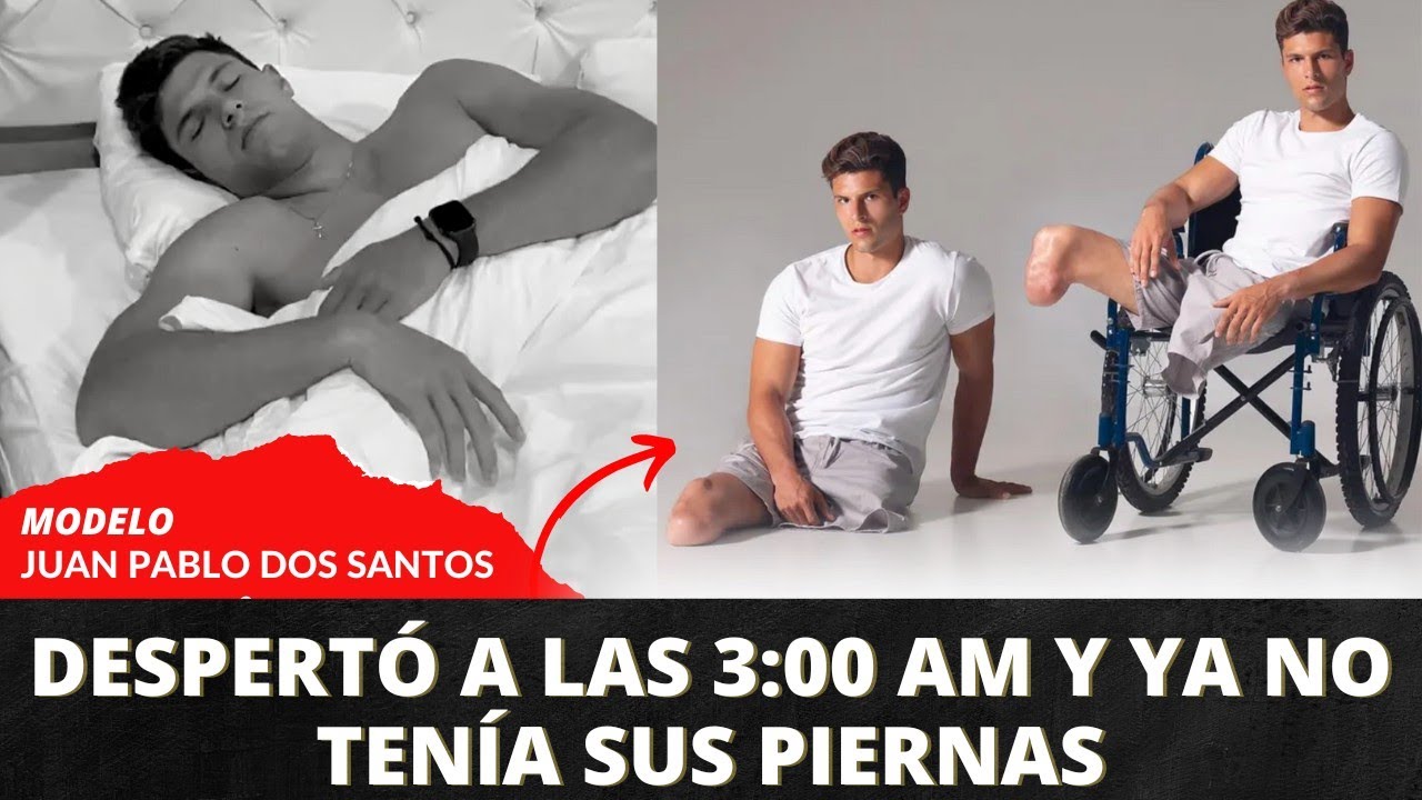 Al despertar LE FALTABAN AMBAS PIERNAS [ Modelo Venezolano Juan Pablo Dos Santos]