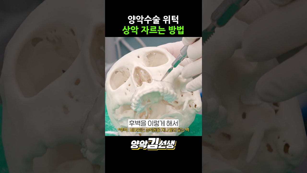 양악수술 상악 자르기 시연 영상💀 위턱뼈를 잘라 보았습니다 #shorts