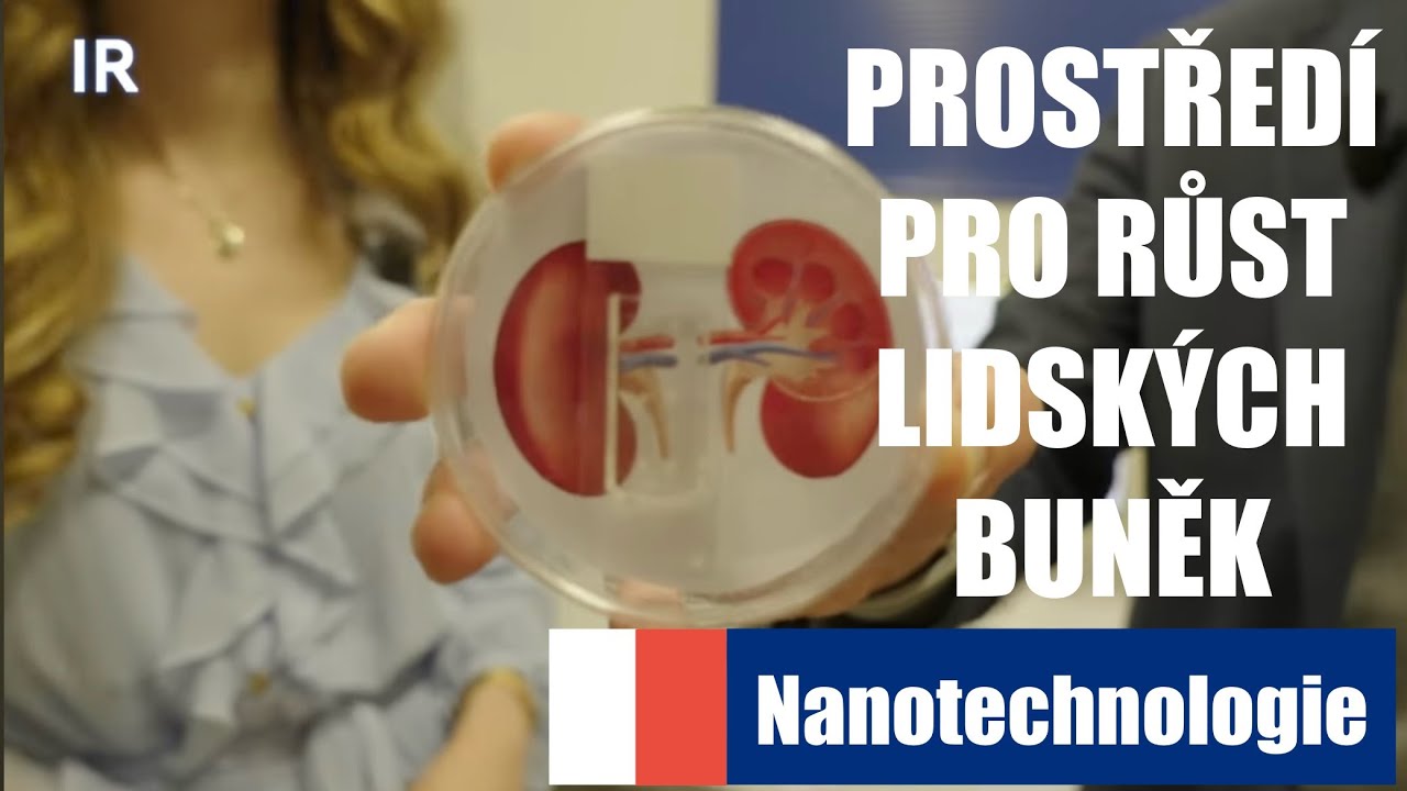 Nanotechnologie - org&aacute;ny na chipu | Mark&eacute;ta Kl&iacute;čov&aacute;