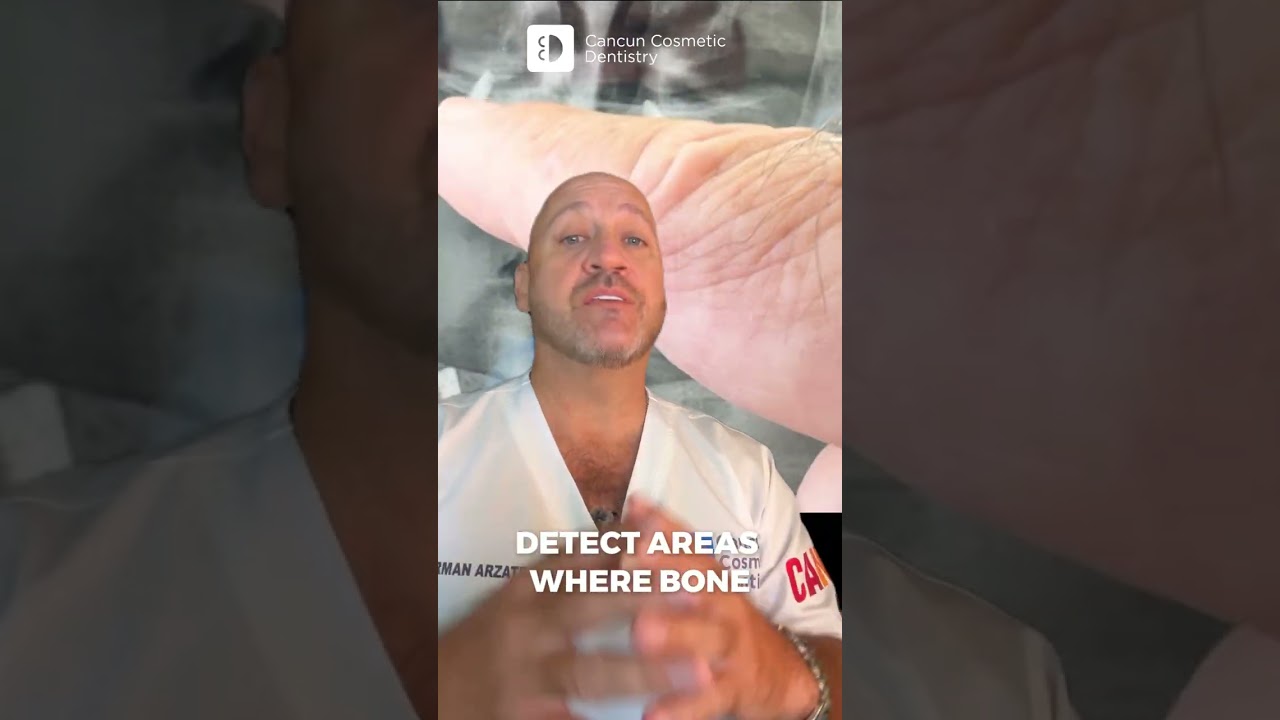🦷 IT’S NOT ABOUT IMPLANTS… IT’S ABOUT PRECISION. 🎯✨