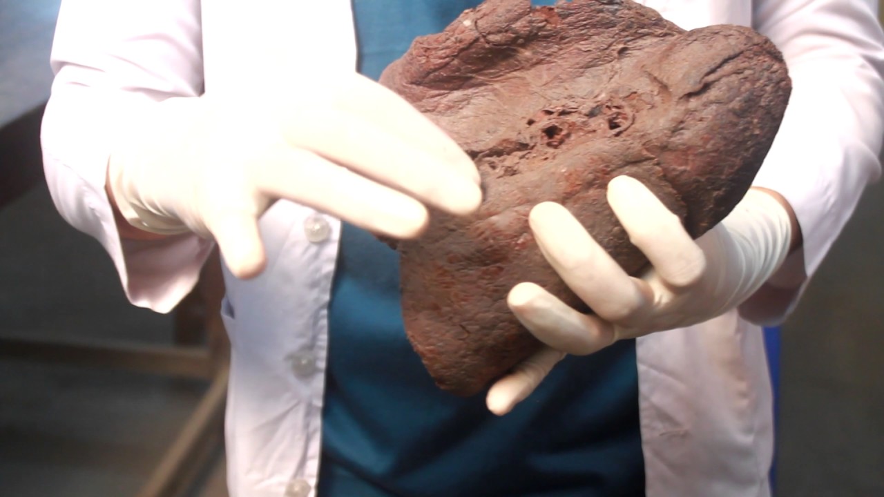 Anatomy :lungs (Anatomical points,structure,attachment,hilum, bronchopulmunary segment,lobes)