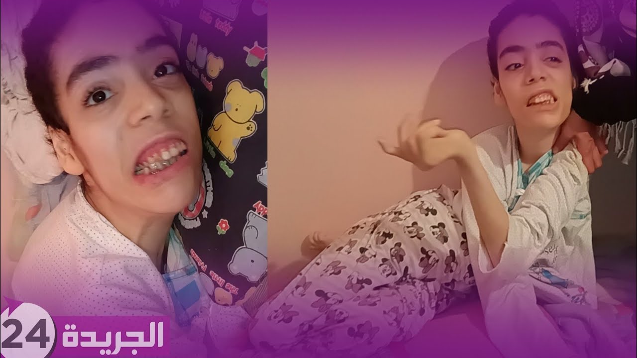 شابة تعاني إعاقة غريبة وعائلتها تناشد أصحاب القلوب الرحيمة بالمكانس بالبيضاء