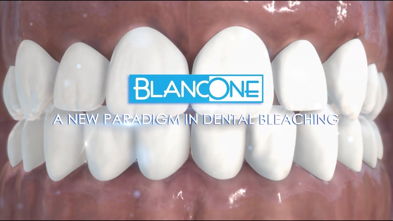 BlancOne reinvents dental bleaching