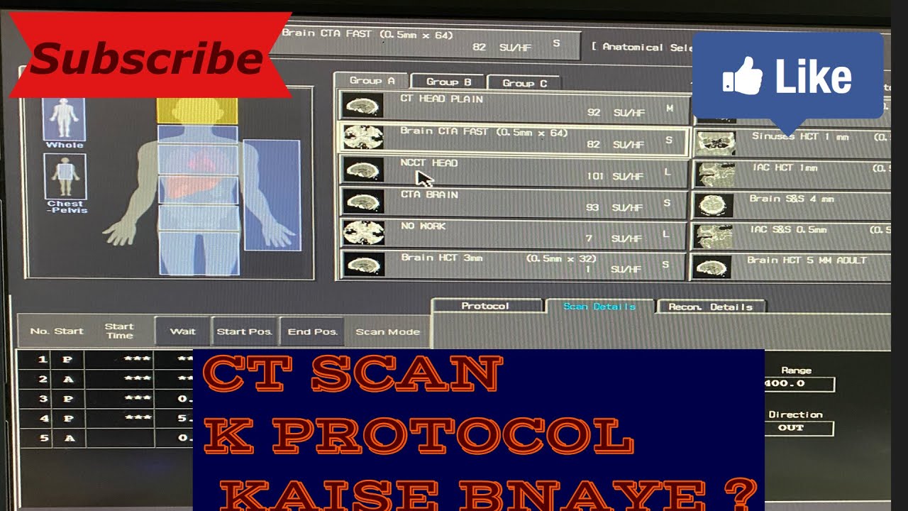 CT SCAN K PROTOCOL KAISE BANAYE.