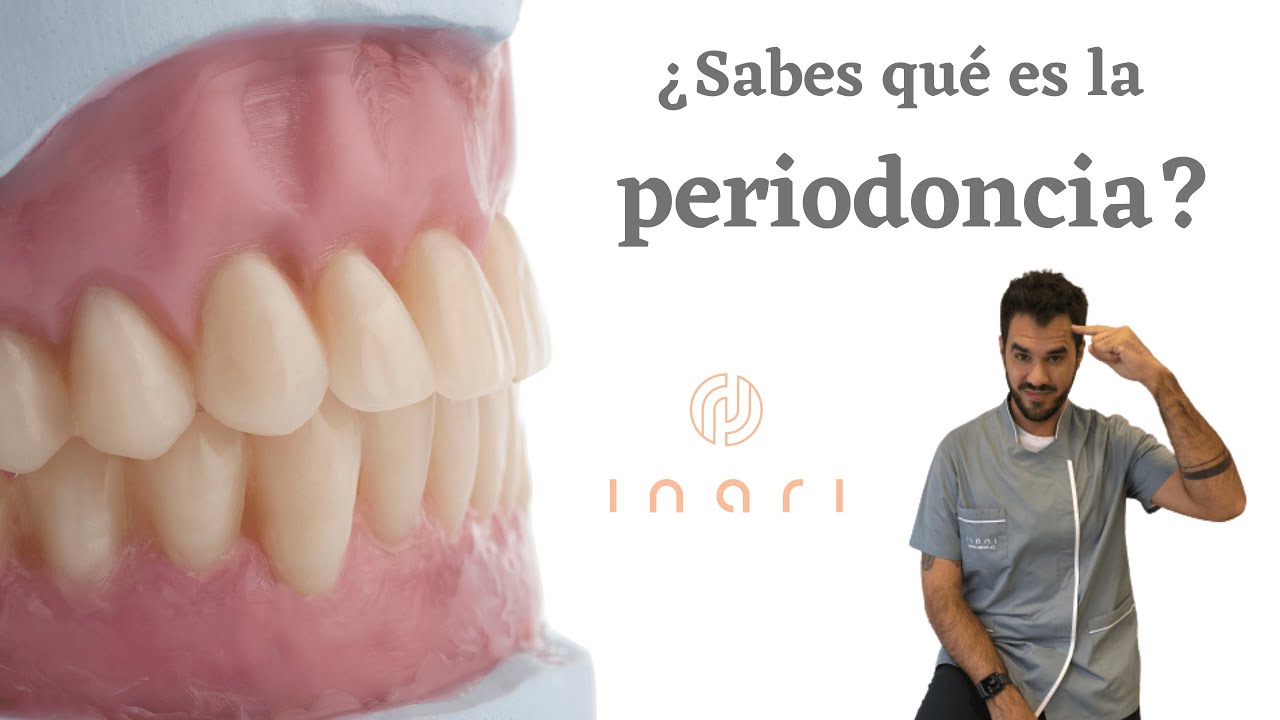 Tratamiento de  periodoncia