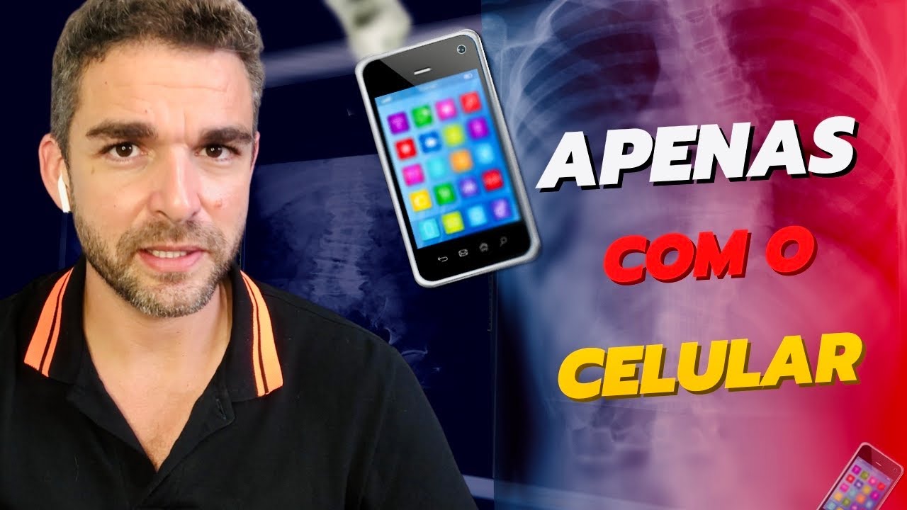ESCOLIOSE | Como Calcular o Ângulo de Cobb com o Celular