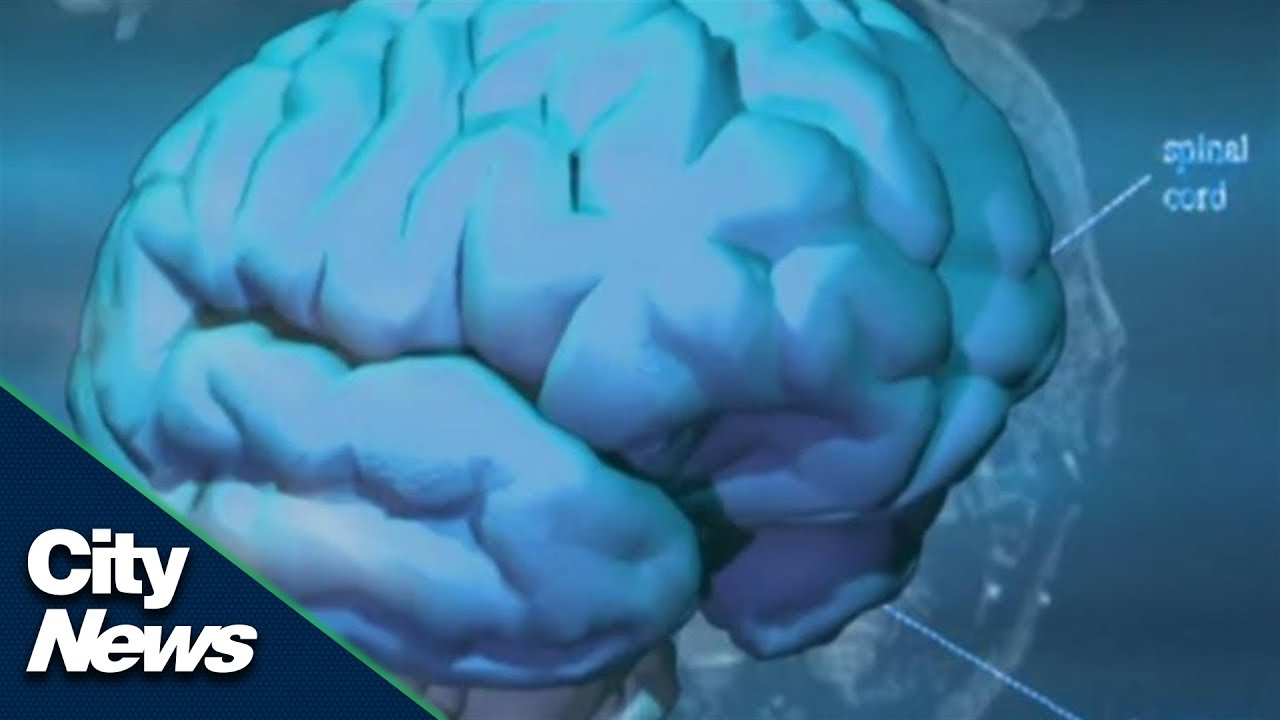 What is COVID-19 &ldquo;brain fog&rdquo; and why should we be concerned?