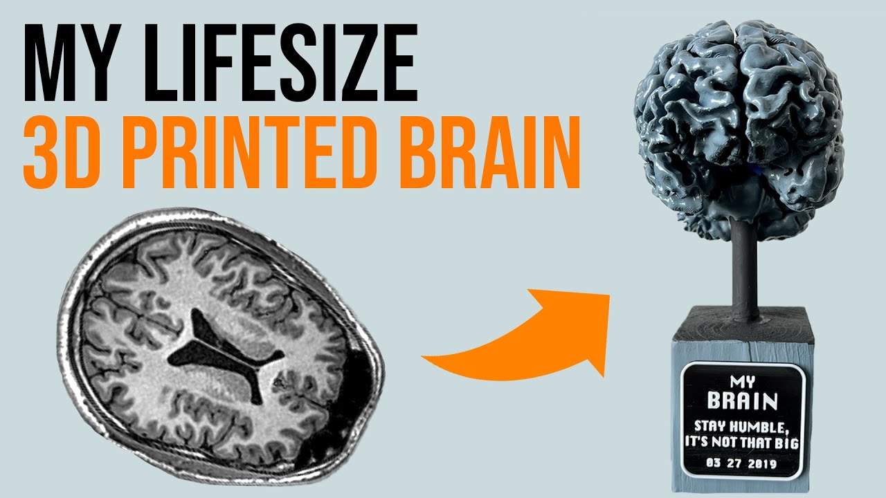 Ultra-Detailed 3D Printed Life Sized Brain From An MRI Scan