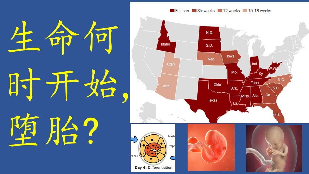 短讲: 胎儿的生命何时开始？ (美国各州堕胎的禁令为何不一样?)