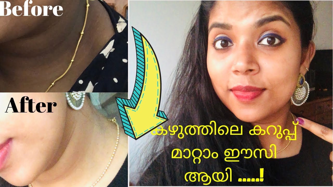 How to Get Rid of Dark Neck //Fast and Easy way/Solution for Black Neck in Malayalam