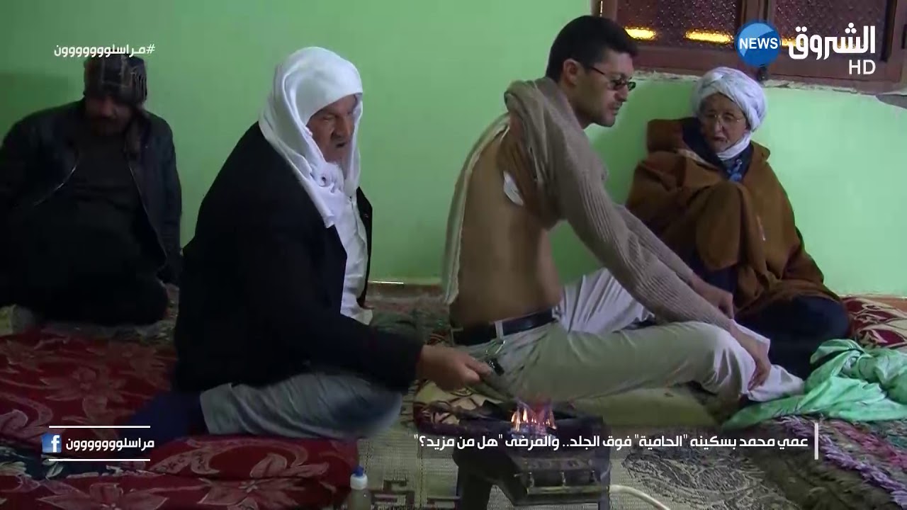 معسكر: الحاج محمد يداوي أمراض المفاصل بالنار