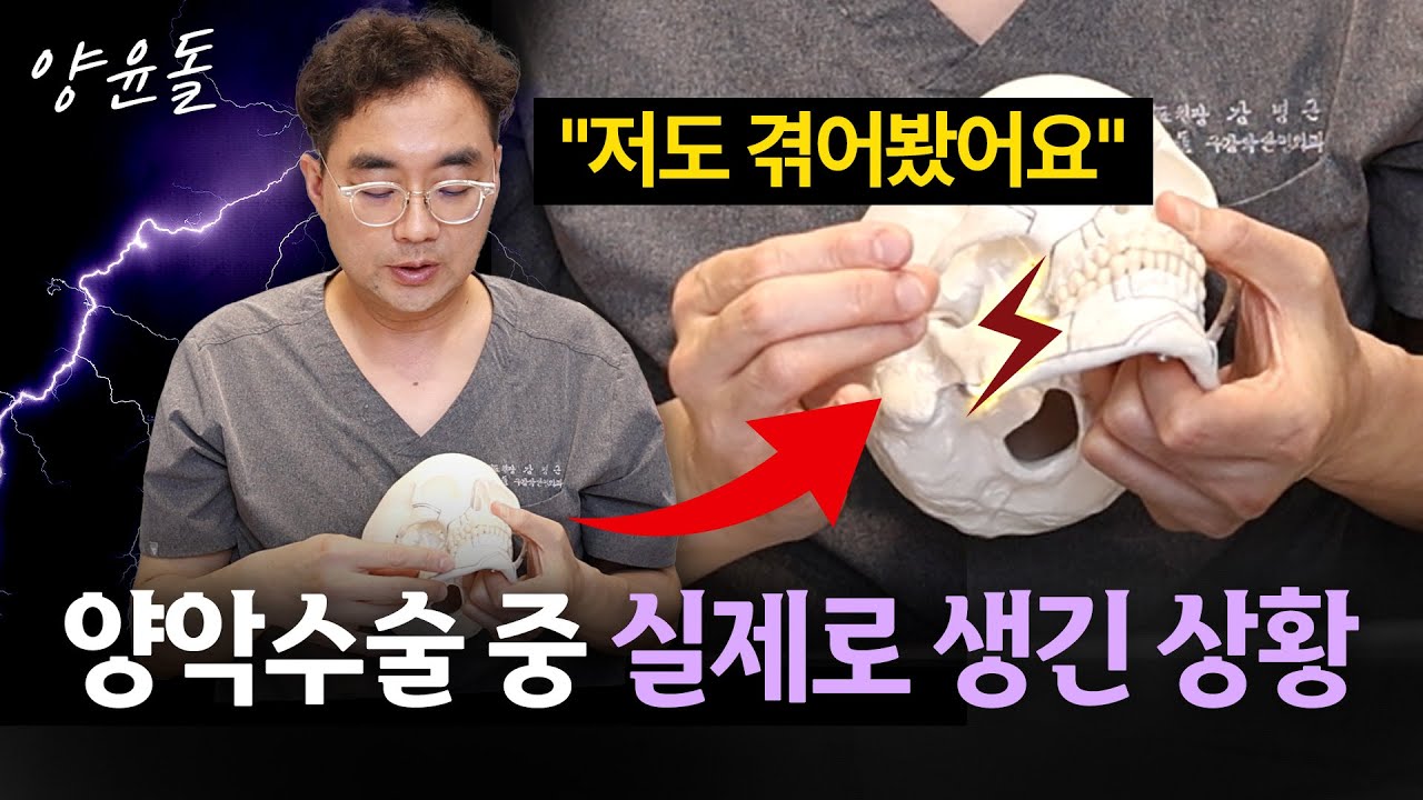 양악 수술 중 실제로 일어난 일 (부작용 주의!)