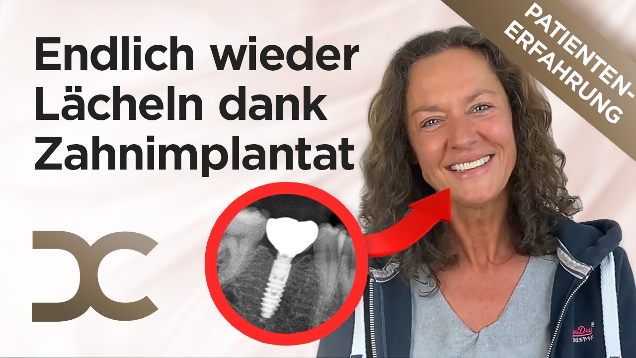 Zahnimplantat Schmerzen? Endlich Hilfe beim Fachzahnarzt | Erfahrungsbericht