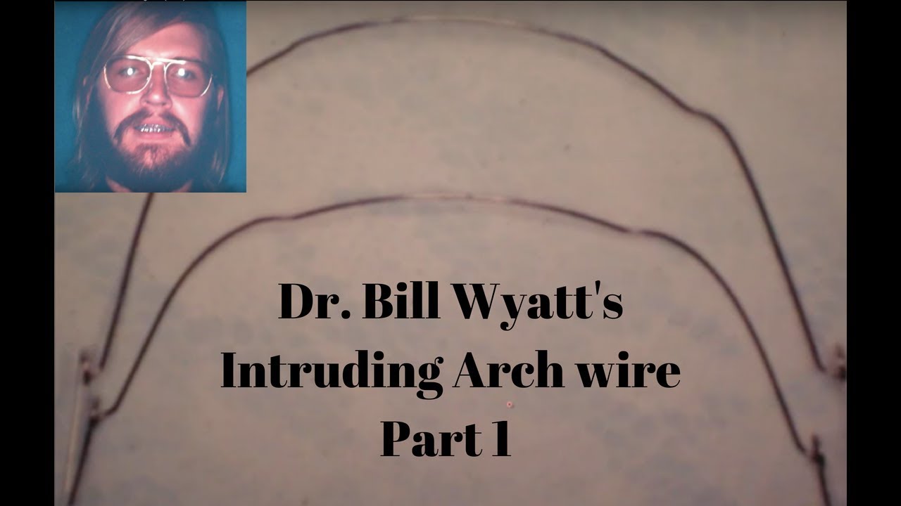 Dr.Bill Wyatt's Intruding Arch wires : The Birth of Intruding Arch (1 of 6)