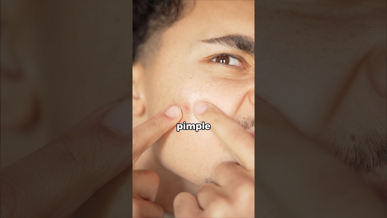 The Quickest Way to Get Rid of Pimples