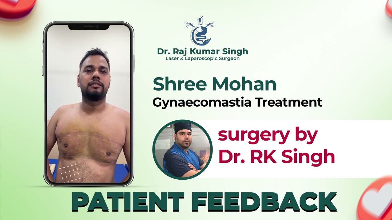 Gynaecomastia treatment | best doctor for Gynaecomastia treatment in Delhi | Dr. Raj Kumar Singh