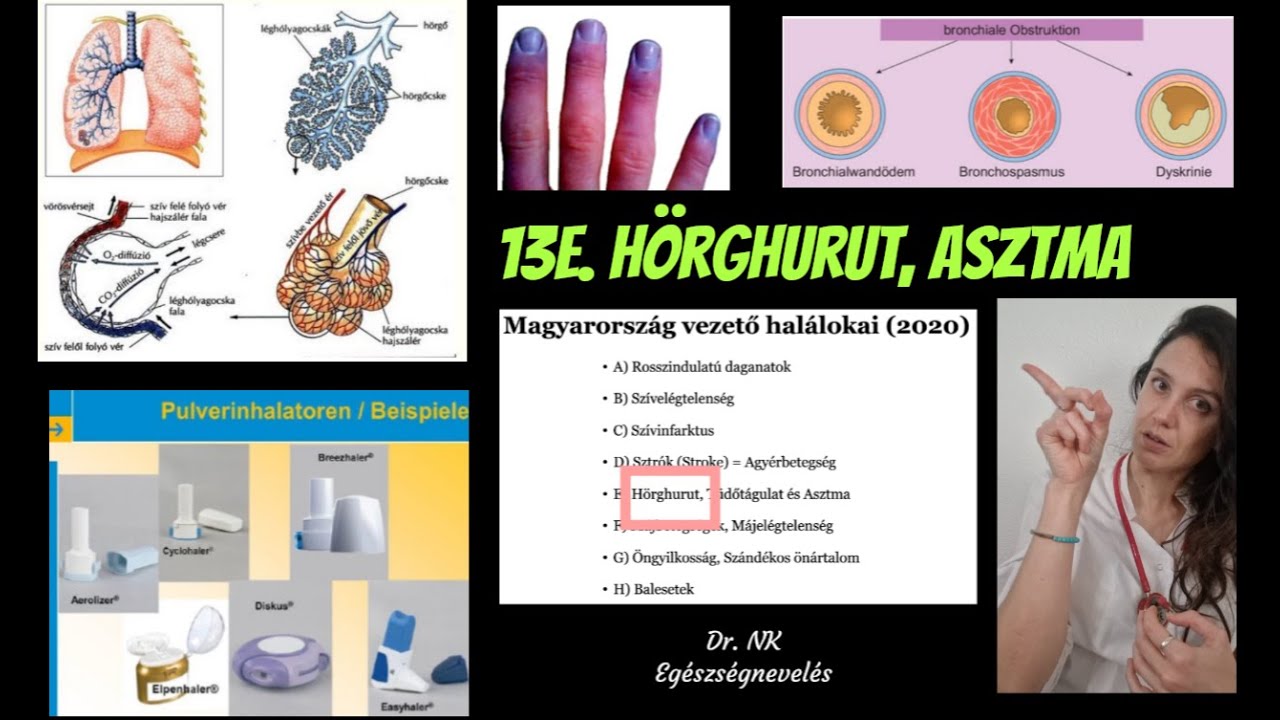 13. M.o. vezető halálokai - 13e. COPD, Asztma