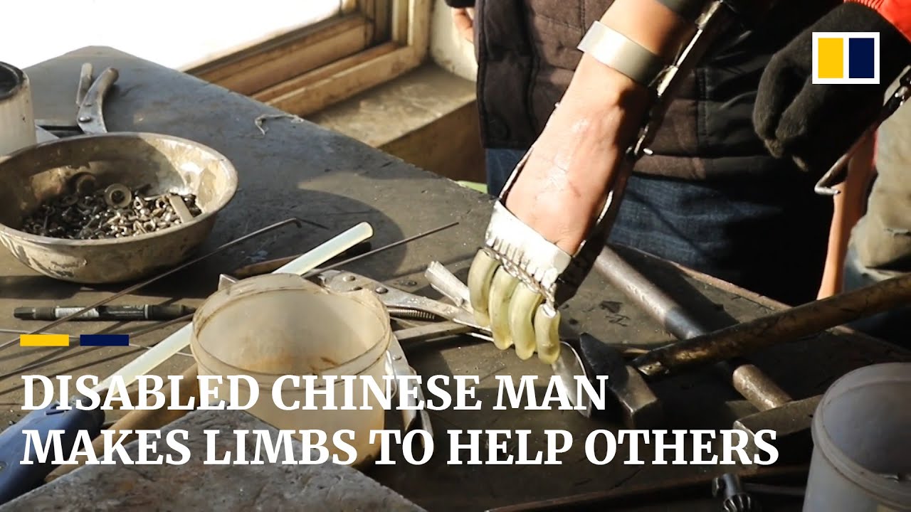 Disabled Chinese man makes artificial limbs for himself and others