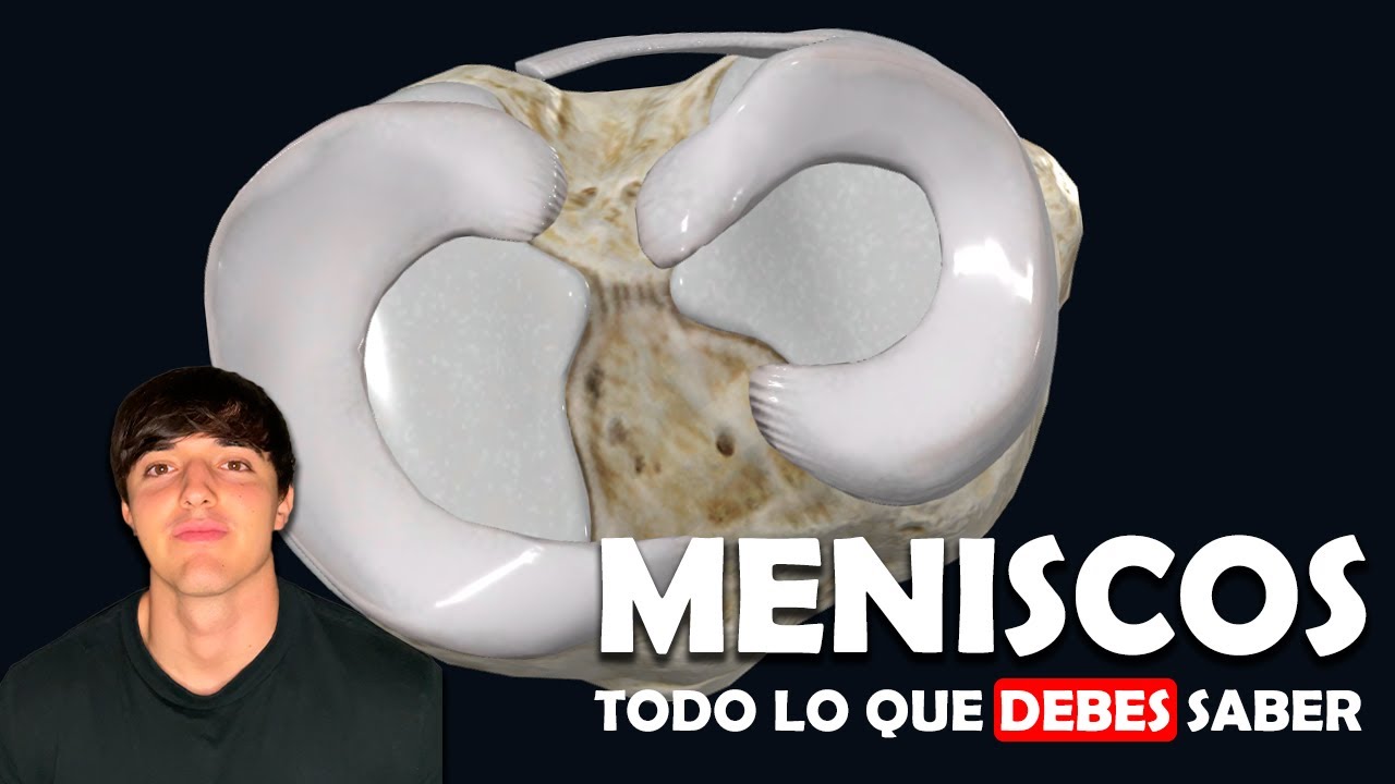 Qué debes saber de los MENISCOS - Ep. 15