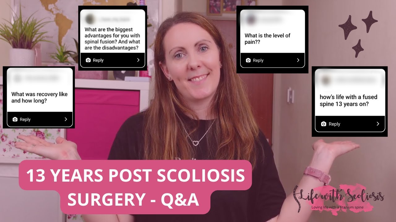 13 years post scoliosis surgery: Q&A | Life with Scoliosis