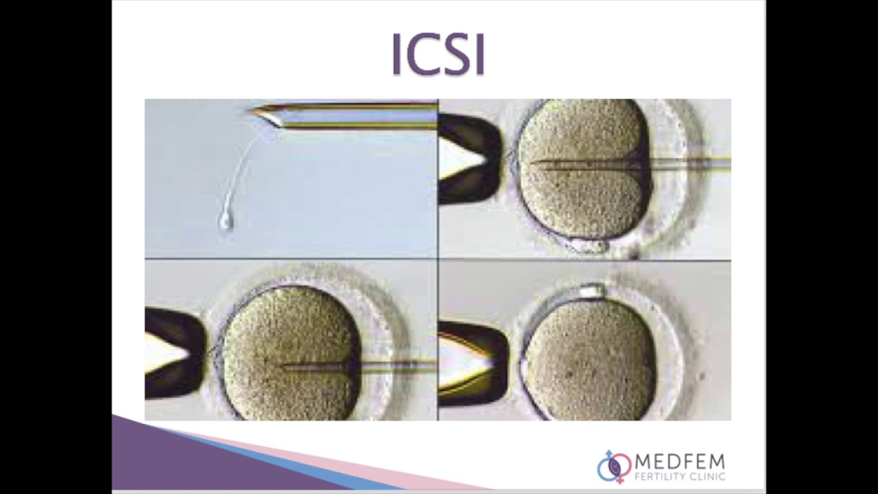 Medfem Fertility Clinic  Masterclass Vlog   Absolute Indication for IVF